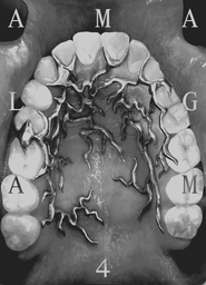 Amalgam logo